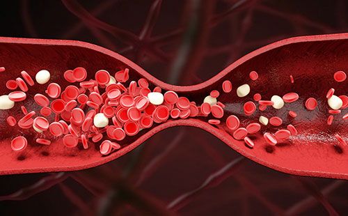 動(dòng)脈硬化檢測(cè)儀