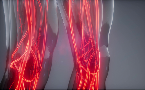 動(dòng)脈硬化檢測(cè)儀