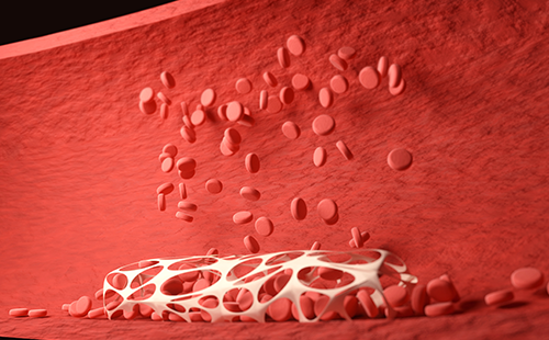 動脈硬化檢測儀