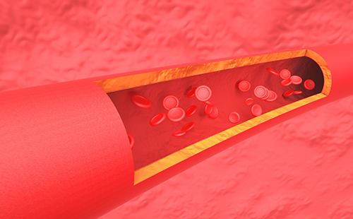 動脈硬化檢測儀