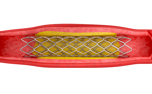 動脈硬化檢測儀