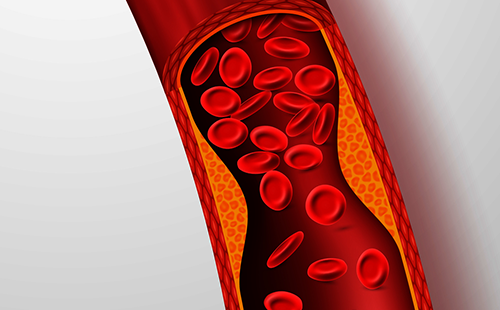 動脈硬化檢測儀