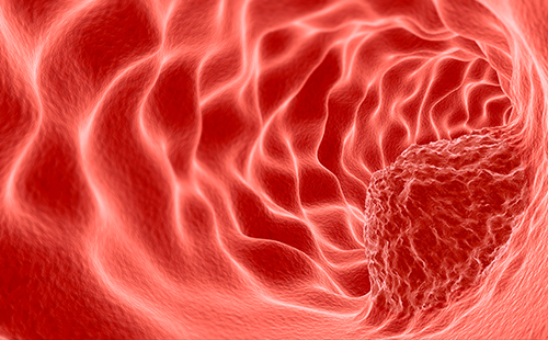 動(dòng)脈硬化檢測儀