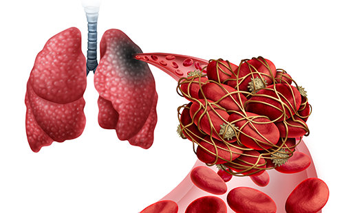 動(dòng)脈硬化檢測儀