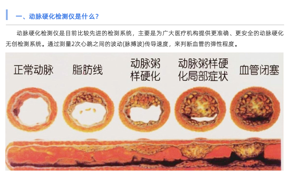 動(dòng)脈硬化檢測(cè)儀