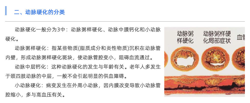 動(dòng)脈硬化檢測(cè)儀