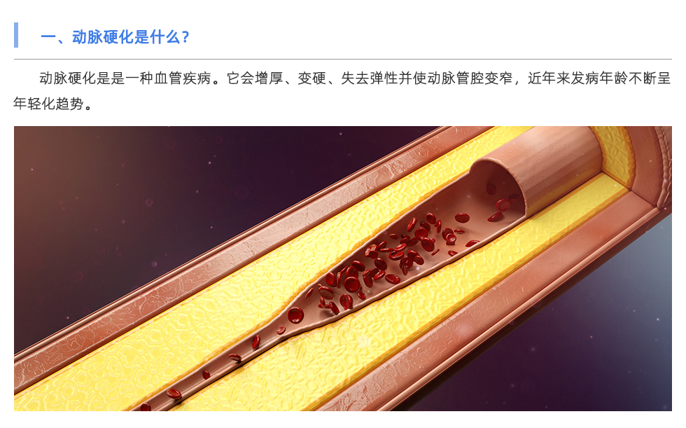 動(dòng)脈硬化檢測(cè)儀