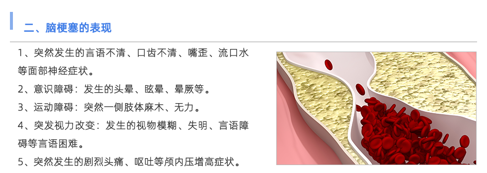 動脈硬化檢測儀