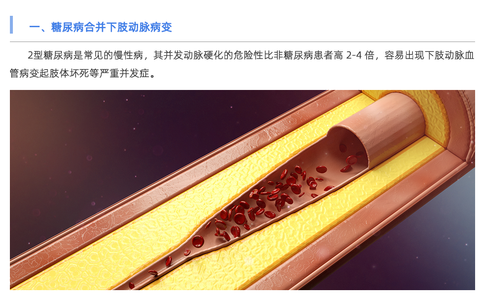 動脈硬化檢測儀