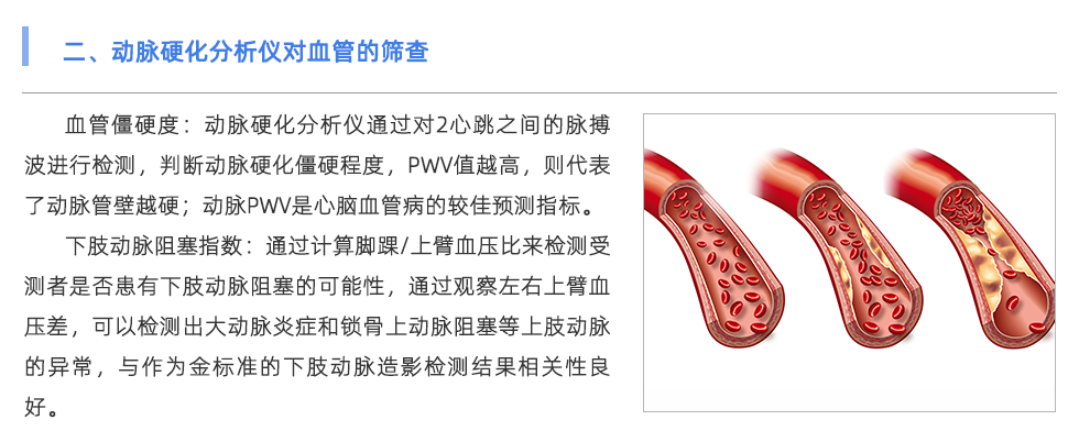 動脈硬化分析儀