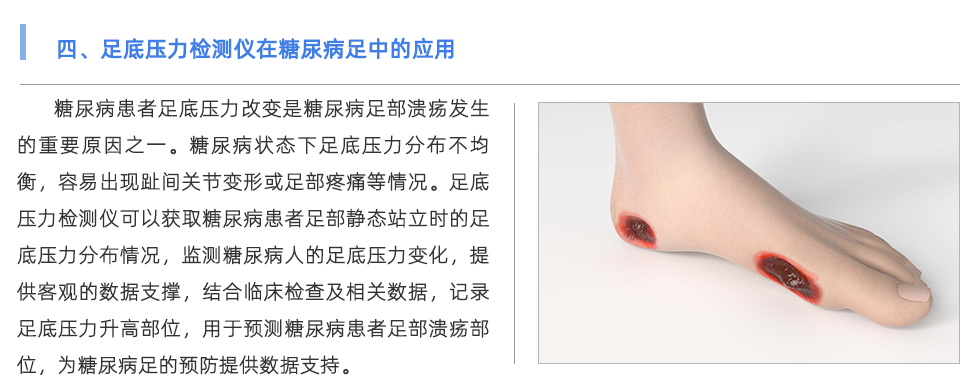 足底壓力檢測(cè)儀