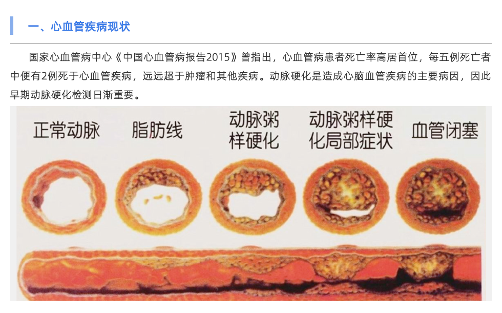 動(dòng)脈硬化檢測(cè)儀