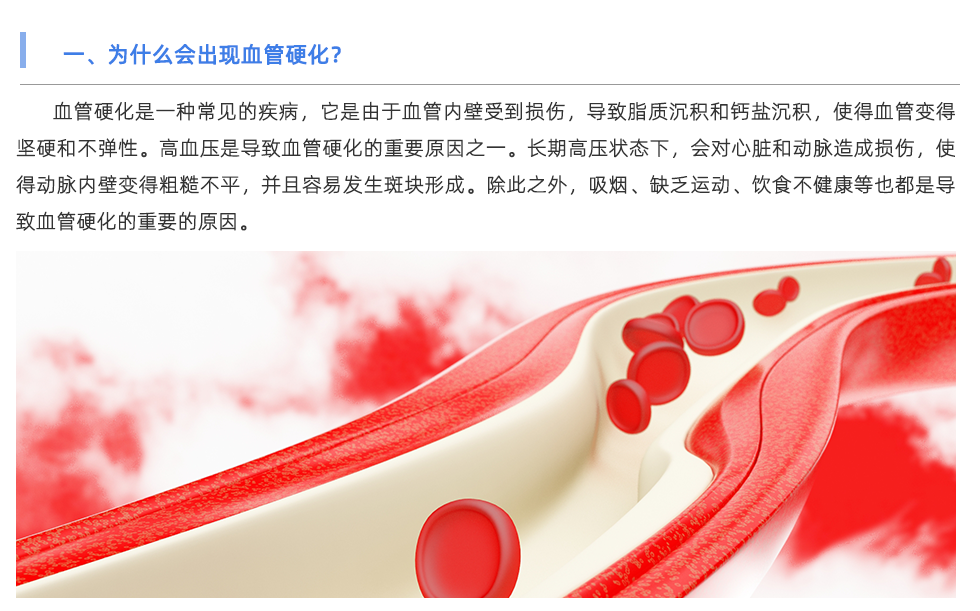 動脈硬化檢測儀