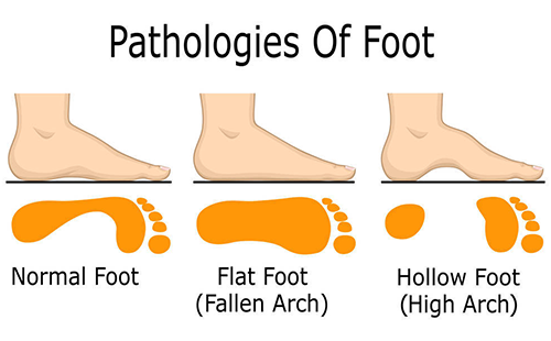 足底壓力檢測(cè)儀